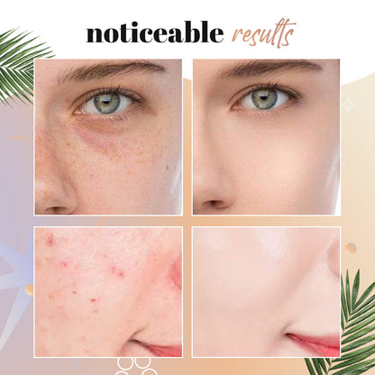 💖BUY 1 GET 1 FREE⏰ - NEENCE® Mushroom Head Air Cushion CC Cream