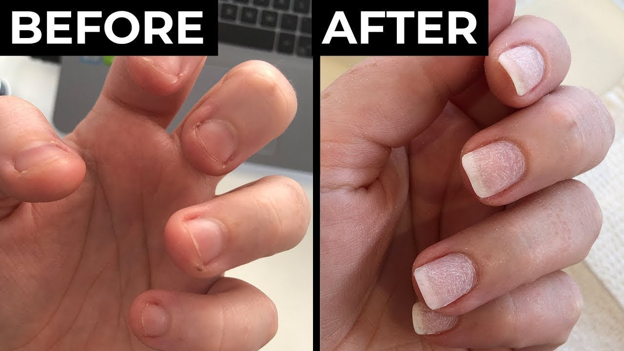 💖Last Day Promotion-50% OFF💅 Cuticle-Oil-(🎁BUY 2 GET 2 FREE🎁)