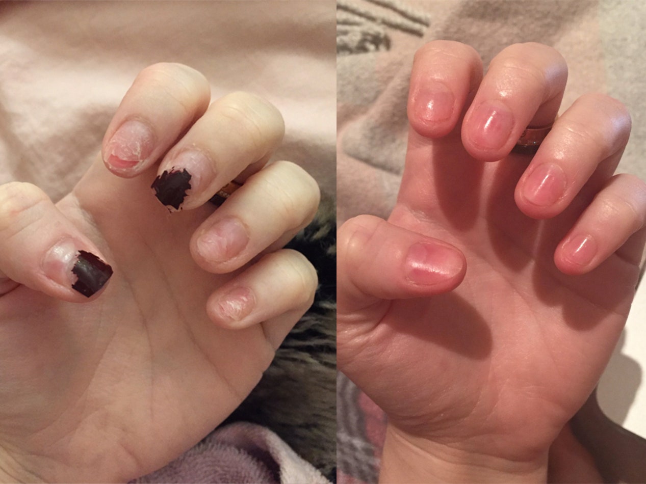 💖Last Day Promotion-50% OFF💅 Cuticle-Oil-(🎁BUY 2 GET 2 FREE🎁)