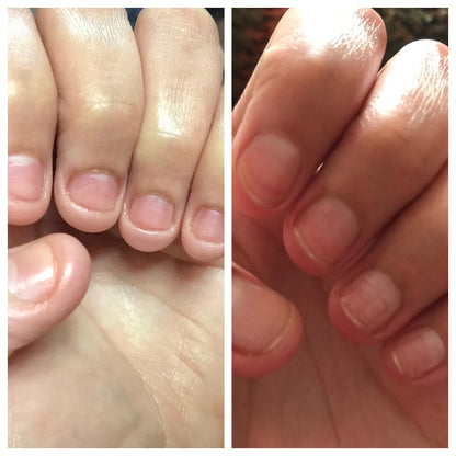 💖Last Day Promotion-50% OFF💅 Cuticle-Oil-(🎁BUY 2 GET 2 FREE🎁)