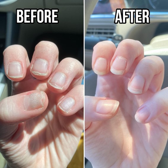 💖Last Day Promotion-50% OFF💅 Cuticle-Oil-(🎁BUY 2 GET 2 FREE🎁)