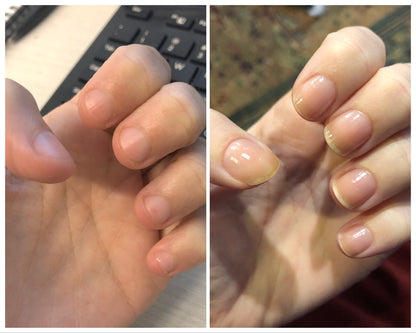 💖Last Day Promotion-50% OFF💅 Cuticle-Oil-(🎁BUY 2 GET 2 FREE🎁)