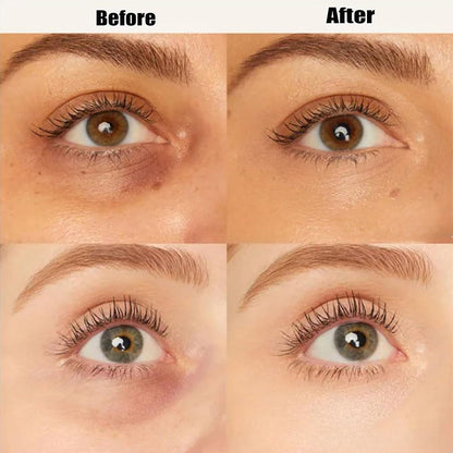 🔥LAST DAY BUY 1 GET 1 FREE (2 PCS)🔥 NEENCE® Colored Clay Undereye Corrector