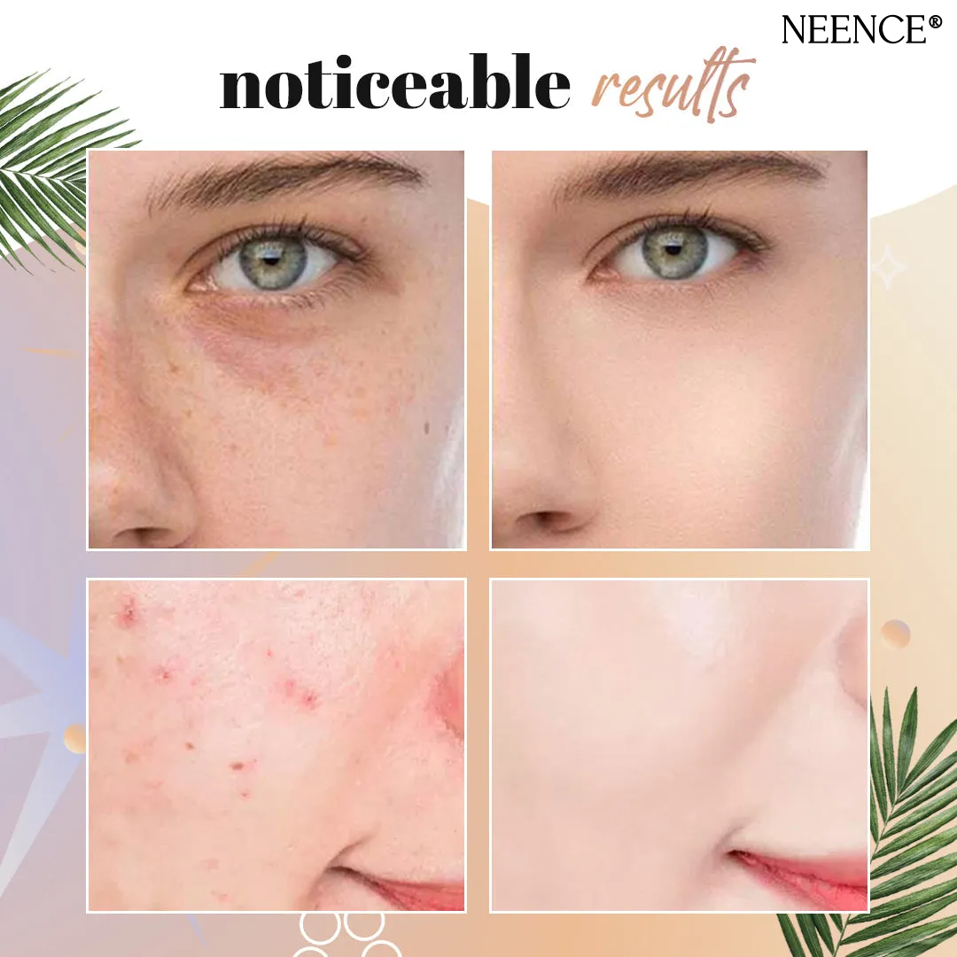🎉Buy One Get One Free🎁 - NEENCE® Mushroom Head Air Cushion CC Cream